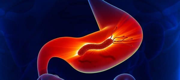 Što je Helicobacter pylori? - Poliklinika ANALIZA
